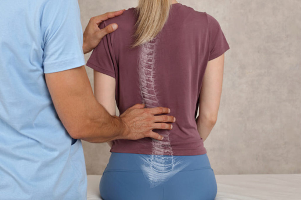 what is scoliosis