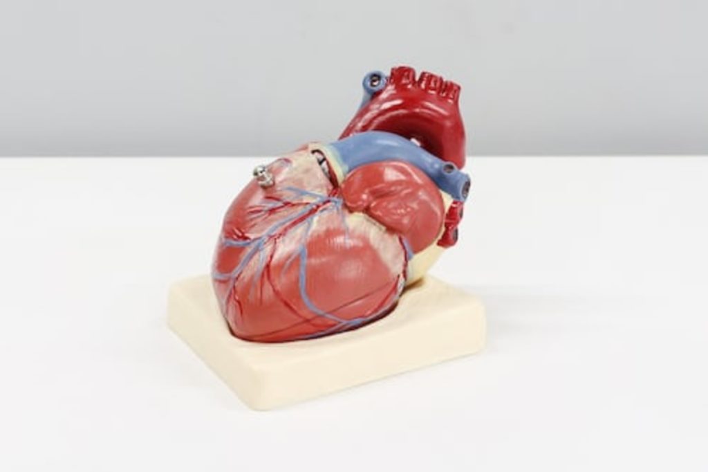 heart failure