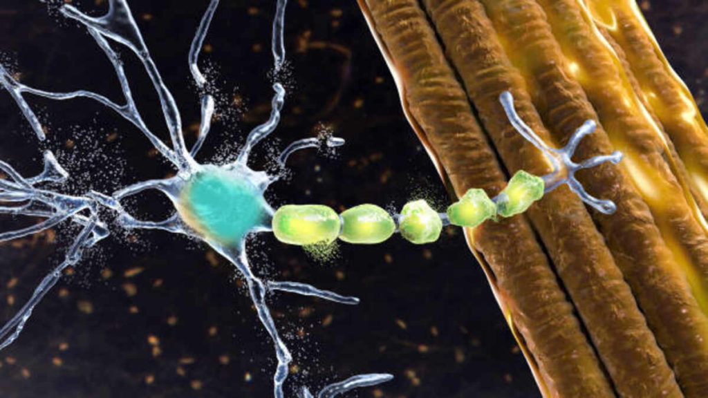 sclerosis