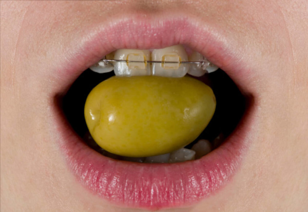 how to fix a crooked smile