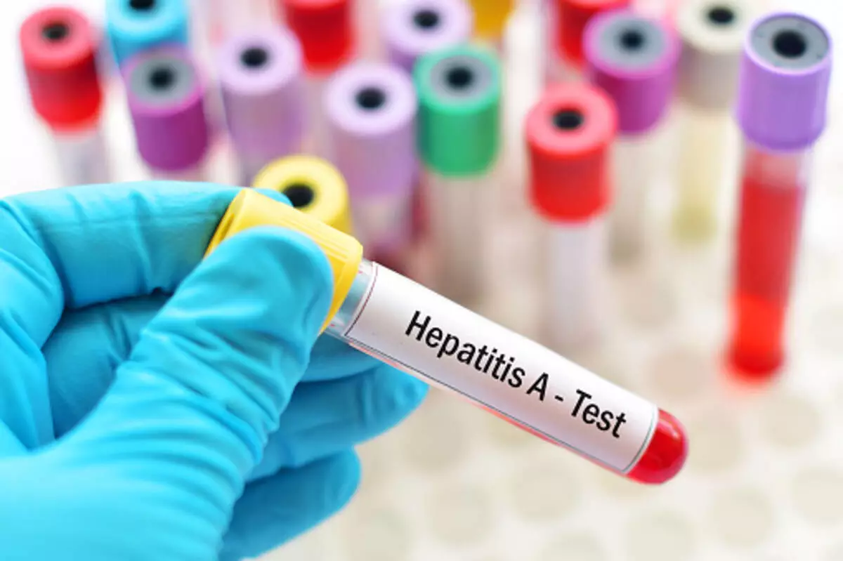 Hepatitis A Information