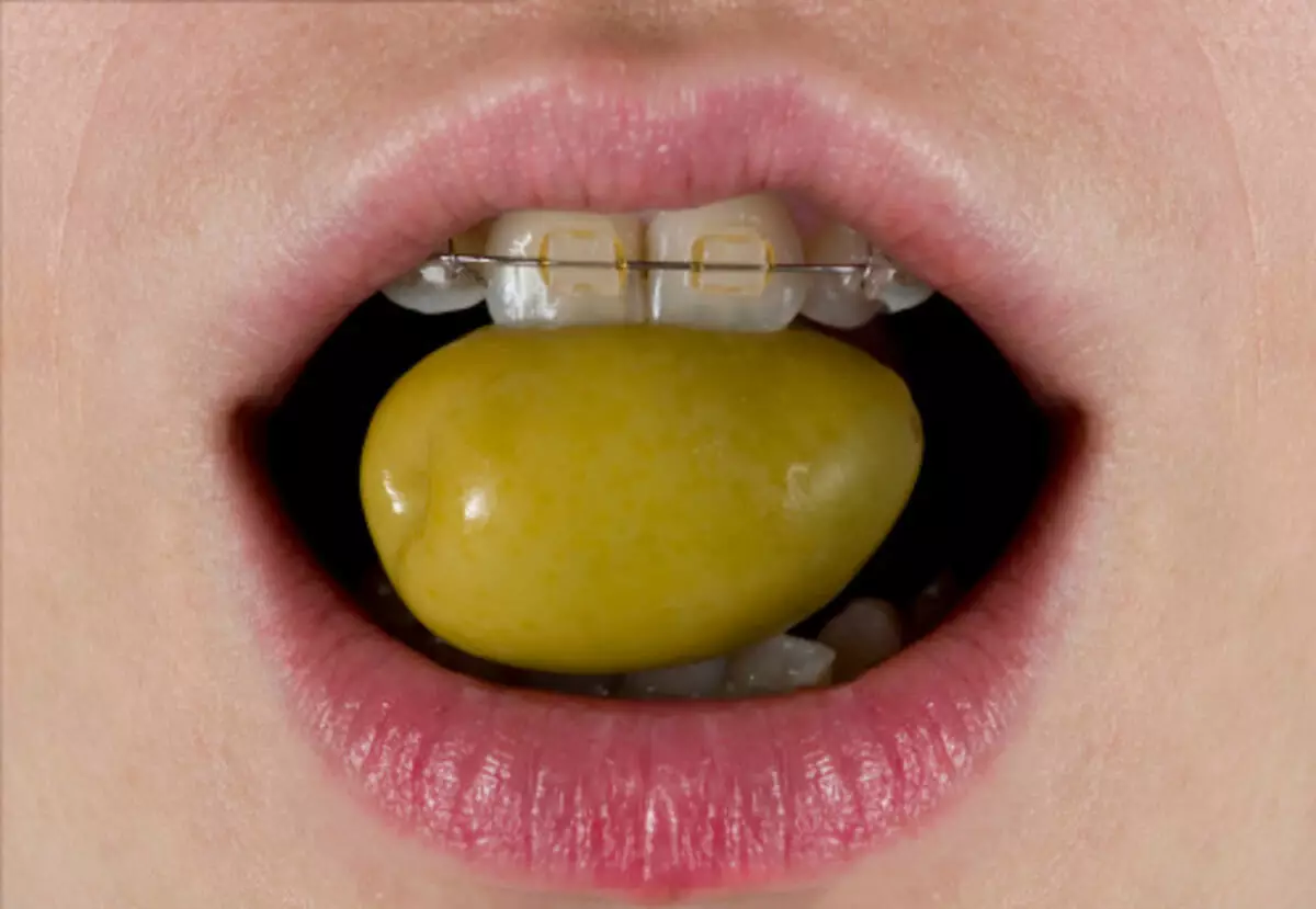 How to Fix a Crooked Smile