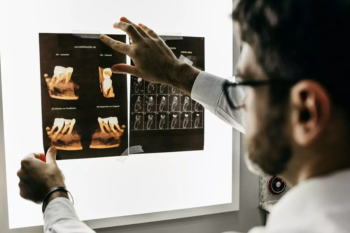 Revealing the Mysteries of Dental Insurance in 2024